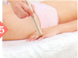 產(chǎn)后缺乳艾灸