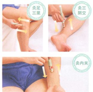 動脈粥樣硬化艾灸