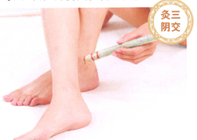經期頭痛艾灸