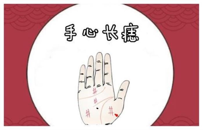 掌心有痣是什么的標志<div   id=