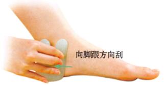 腰椎間盤(pán)突出刮痧