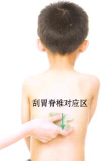 小兒腹瀉刮痧