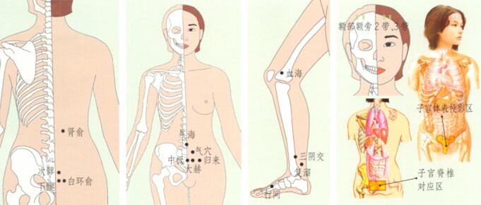 子宮肌瘤刮痧